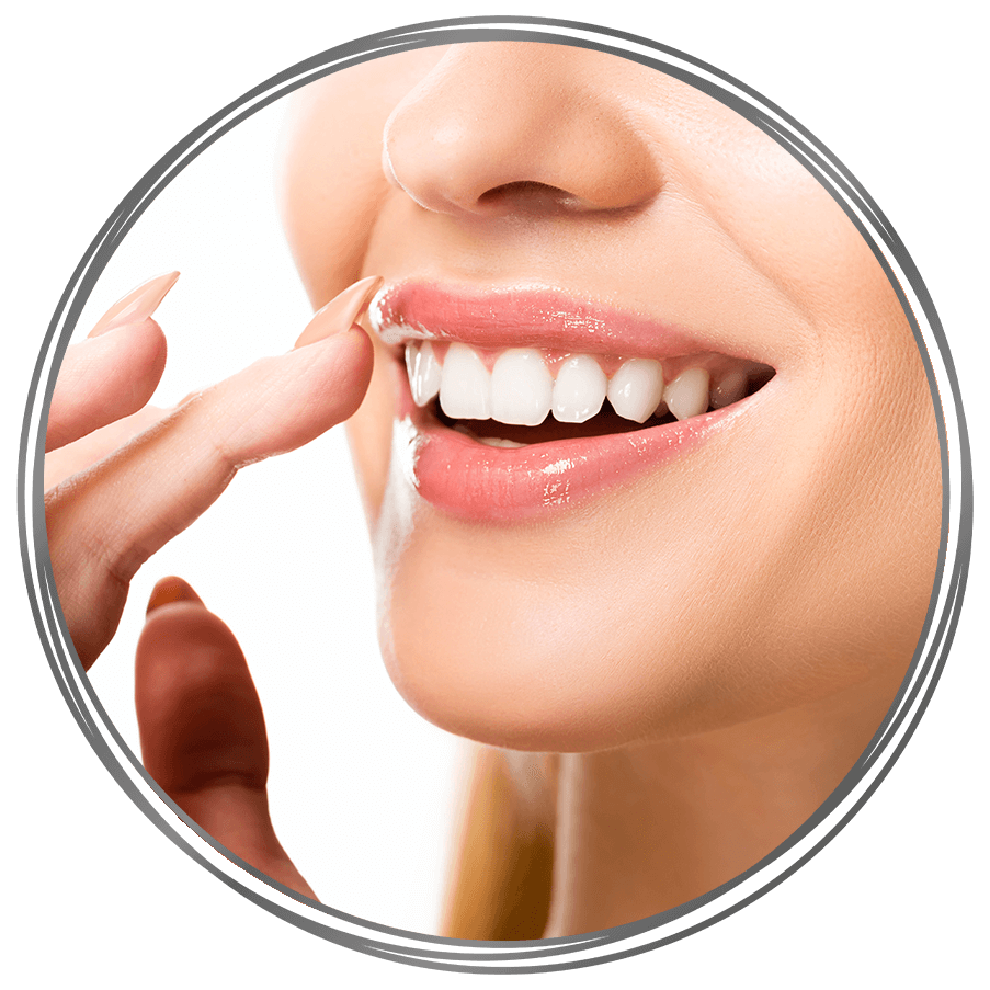Diamoneers™ Porcelain Veneers